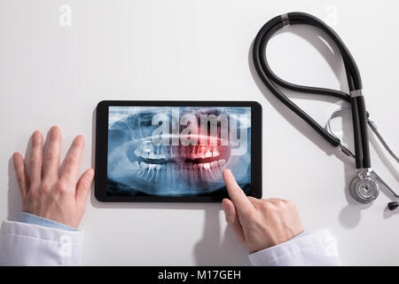 Medico la mano e tavoletta digitale schermata che mostra denti X-ray con uno stetoscopio sulla scrivania bianca Foto Stock