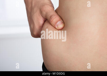 Close-up di una donna di mano schiacciamento eccessivo grasso Stomaco Foto Stock