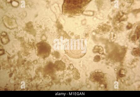 Microfotografia di un uovo da una Hymenolepis diminuta cestode, il ratto tenia che provoca l'infezione intestinale negli esseri umani hymenolepiasis, 1979. Immagine cortesia CDC. () Foto Stock