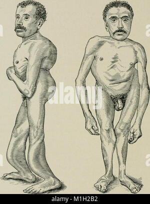 Questo libro del 1906 delinea i principi completi della chirurgia, unendo le conoscenze scientifiche con le tecniche pratiche. Funge da risorsa chiave per i chirurghi, descrivendo in dettaglio varie procedure mediche e pratiche chirurgiche essenziali sia per gli studenti che per i professionisti del settore. Foto Stock