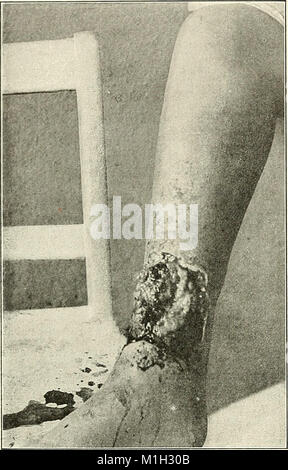 La prassi americana di Chirurgia; un sistema completo di scienza e arte della chirurgia (1906) (14770571222) Foto Stock