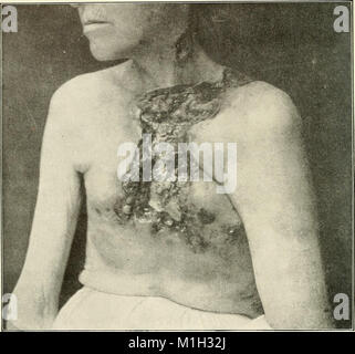 La prassi americana di Chirurgia; un sistema completo di scienza e arte della chirurgia (1906) (14584235659) Foto Stock