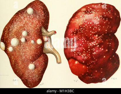 Un manuale di riferimento delle scienze mediche che abbraccia tutto il campo della ricerca scientifica e la medicina pratica e allied Science (1900) (14587025077) Foto Stock