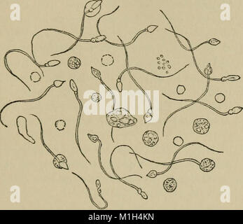 Un manuale di diagnosi clinica per mezzo di microscopiche e metodi chimici, per gli studenti, ospedale medici e terapeuti (1902) (14576805709) Foto Stock