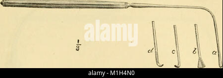 Un manuale di malattie del naso e della gola - compresa la faringe, la laringe, la trachea, l'esofago, naso e rinofaringe (1880) (14596358397) Foto Stock