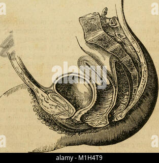 Un compendio analitico dei vari rami della scienza medica, per l'uso e l'esame degli studenti (1848) (17548363754) Foto Stock