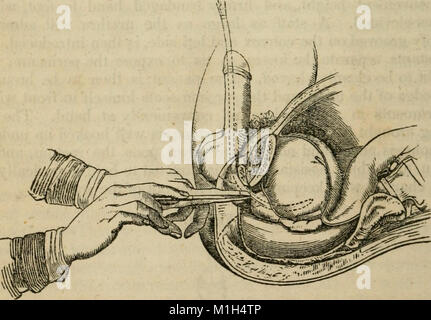 Un compendio analitico dei vari rami della scienza medica, per l'uso e l'esame degli studenti (1848) (18144333776) Foto Stock