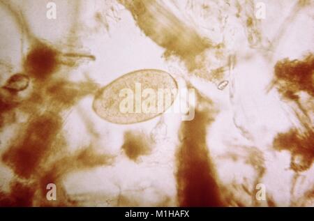 Microfotografia di un fegato di pecora (Fluke Fasciola hepatica) uovo, un trematode parassita che provoca la malattia Fascioliasis, 1979. Immagine cortesia CDC. () Foto Stock