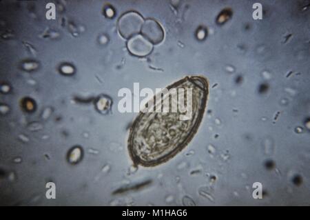 Microfotografia di una flatworm (Clonorchis sinensis) uovo, un trematode parassita o di un fegato umano fluke che provoca la malattia Clonorchiasis, 1979. Immagine cortesia CDC. () Foto Stock