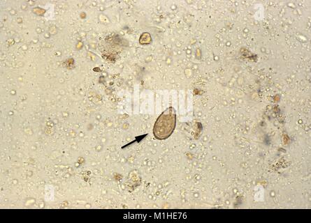 Orientali o fegato cinese fluke uovo (Clonorchis sinensis) ha rivelato nella micrografia film, 1986. Immagine cortesia di centri per il controllo delle malattie (CDC). () Foto Stock