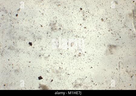 Orientali o fegato cinese fluke uova (Clonorchis sinensis) ha rivelato nella micrografia film, 1979. Immagine cortesia di centri per il controllo delle malattie (CDC) / Dr Mae Melvin. () Foto Stock