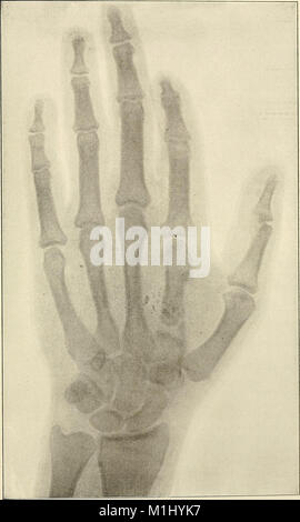 La prassi americana di Chirurgia; un sistema completo di scienza e arte della chirurgia (1906) (14767896161) Foto Stock