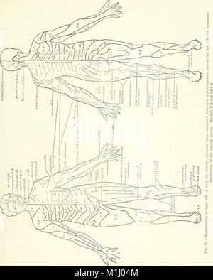 Un atlante della diagnosi differenziale delle malattie del sistema nervoso; analitico e neurologici semeiological grafici (1913) (14761567181) Foto Stock