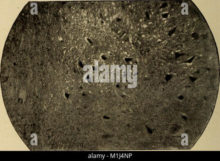 Un trattato sulle malattie del sistema nervoso dei bambini, per i medici e gli studenti (1905) (14761674636) Foto Stock