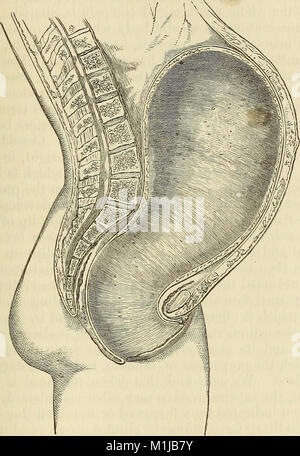 Un sistema di ostetricia, comprese le malattie della gravidanza e stato puerperale (1875) (14766606625) Foto Stock