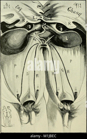 Un trattato di ostetricia per studenti e professionisti (1896) (14734574906) Foto Stock