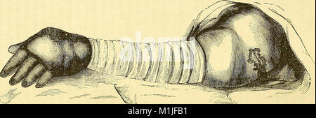 Un sistema di chirurgia - patologico, diagnostico, terapeutico e operativa (1866) (14595009268) Foto Stock