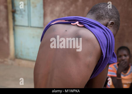 Karamoja, Uganda. Il 1° febbraio 2018. Un 12-anno-vecchio mostra le cicatrici che ha ricevuto quando parenti batterla dopo che ha tentato la fuga da un matrimonio con un uomo più anziano. Lei è ora nella scuola a Kalas ragazze scuola primaria, Amudat distretto, Karamoja, Uganda. Credito: Sally Hayden/SOPA/ZUMA filo/Alamy Live News Foto Stock