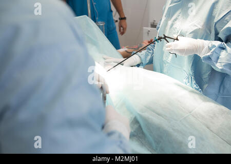 Medico e di assistenza del team medico di eseguire l'intervento chirurgico su un paziente in sala operatoria. Strumenti per laparoscopia. chirurgo operante in ospedale o cl Foto Stock