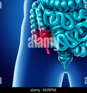 Appendice dolore e infiammazione appendicite concetto di malattia come una chiusura di intestino umano anatomia come 3D'illustrazione. Foto Stock