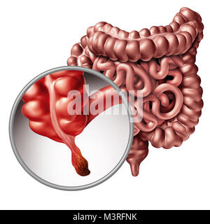 Appendicite e appendice infiammazione concetto di malattia come una chiusura di intestino umano anatomia come 3D'illustrazione. Foto Stock