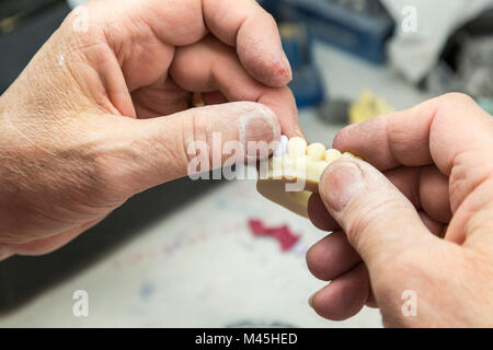 Voce maschile Odontotecnico lavora su un 3D dello stampo stampato per impianti di dente in laboratorio. Foto Stock