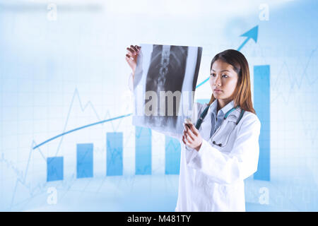 Immagine composita di asian medico controllo MRI scan Foto Stock