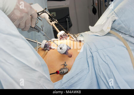 Ritratto di bypass gastrico chirurgia in ospedale Foto Stock