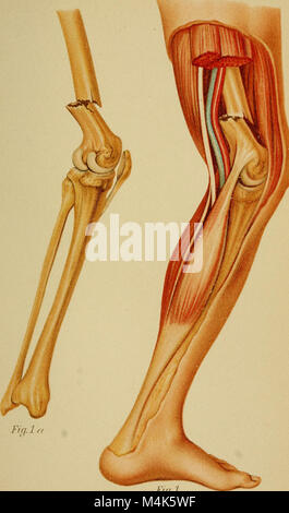 Atlas e epitome di fratture traumatiche e dislocazioni (1902) (14778144094) Foto Stock