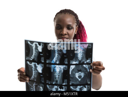 Closeup ritratto intellettuale della donna africana medico sanitario con il bianco labcoat, guardando il collo x-ray immagine radiografica, scansione CT, MRI, isolato Foto Stock