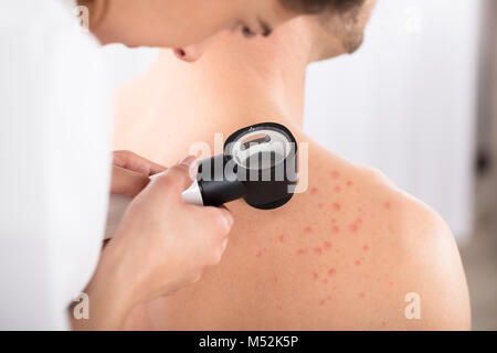 Il dermatologo femmina esaminando Acnes del paziente con Dermatoscope Foto Stock