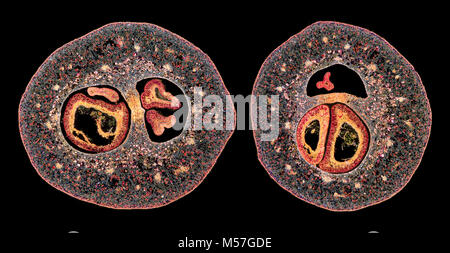 Campo oscuro fotomicrografia, comune frutti di sorbo montano, Sorbus aria, TS Foto Stock