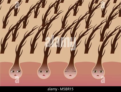 Cartoon follicoli dei capelli sul cuoio capelluto soffrono di secchezza Illustrazione Vettoriale