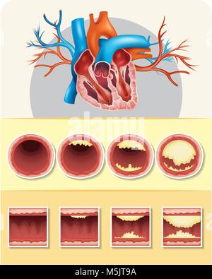 Diagramma che mostra il grasso nel cuore umano illustrazione Illustrazione Vettoriale