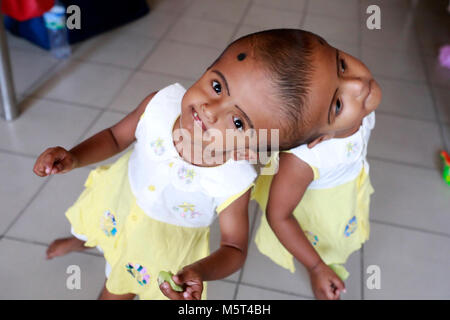 Dacca in Bangladesh. Il 26 febbraio, 2018. Ricollegate due gemelle Rabeya Islam e Islam Rokeya giocare presso un ospedale a Dhaka, nel Bangladesh. Taslima Khatun, un insegnante della scuola, ha dato una nascita del congiunto intitolato Gemelli il 16 Luglio 2016 dopo un taglio cesareo. I gemelli sono stati ammessi a Dhaka Medical College Hospital per esame prima della chirurgia potenzialmente per separare le loro teste. Credito: SK Hasan Ali/Alamy Live News Foto Stock