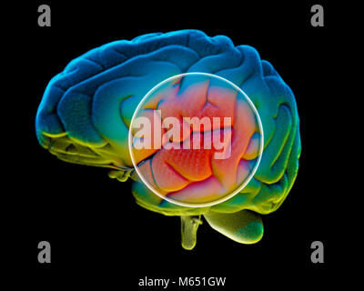 Cervello malattie degenerative, morbo di Parkinson, Sinapsi, neuroni, il morbo di Alzheimer, rendering 3D Foto Stock