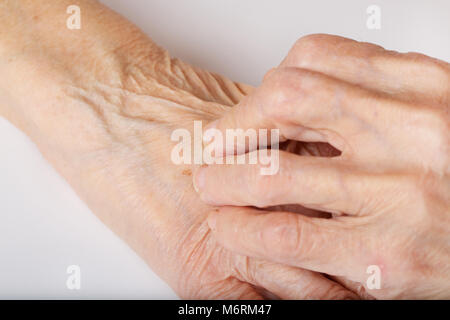 Le mani di una donna anziana tra 70 e 80 anni Foto Stock