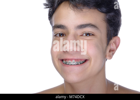 Carino adolescente con sfondo bianco, indossando rinforzi su i suoi denti. Foto Stock