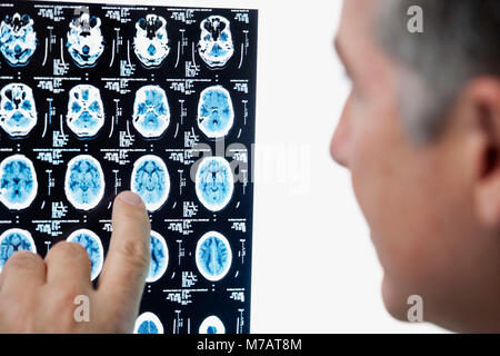 Medico di esaminare il report di MRI Foto Stock