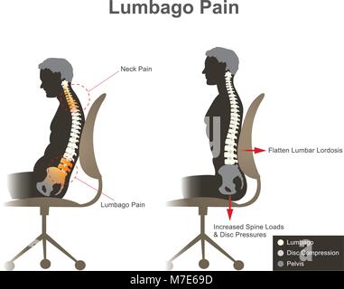 Lombalgia dolore. Health care info vettore grafico. Illustrazione Vettoriale