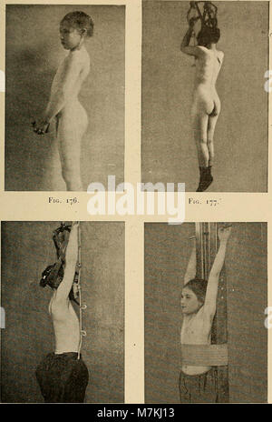 Atlas Manuel de gymnastique orthopédique - Traitement des déviations de la taille; 51 planches comprenant 209 figure, et 53 figure dans le texte (1903) (14580374068) Foto Stock
