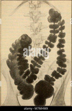 Anatomie médico-chirurgicale de l'addome (1922) (14598269658) Foto Stock