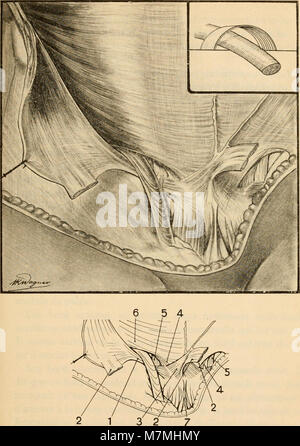 Anatomie médico-chirurgicale de l'addome (1922) (14781733071) Foto Stock