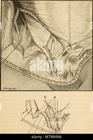 Anatomie médico-chirurgicale de l'addome (1922) (14784879805) Foto Stock