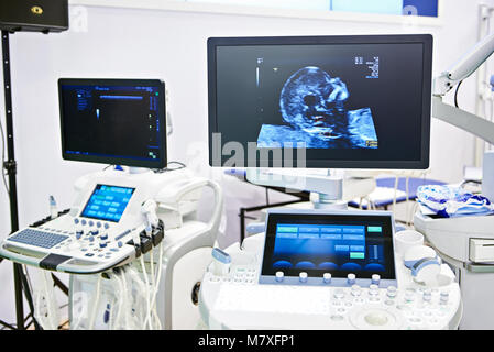 Dispositivi medici per l'esame ecografico e schermo bambino immagine di testa Foto Stock