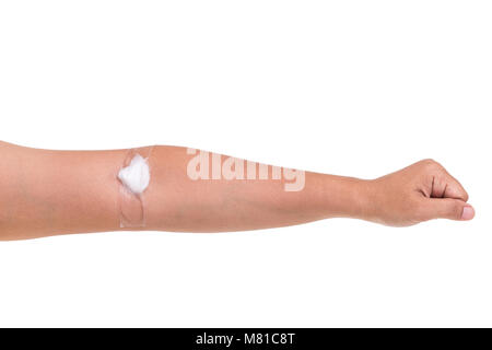 Sul lato sinistro del braccio di donna con cotone bianco dopo la presa campione di sangue isolati su sfondo bianco Foto Stock