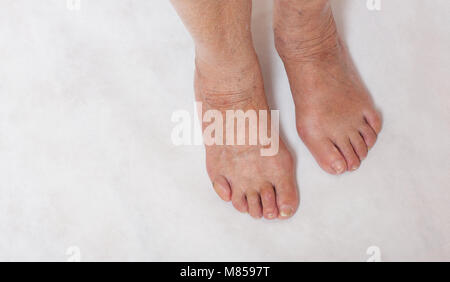 I piedi di una donna senior tra 70 e 80 anni Foto Stock