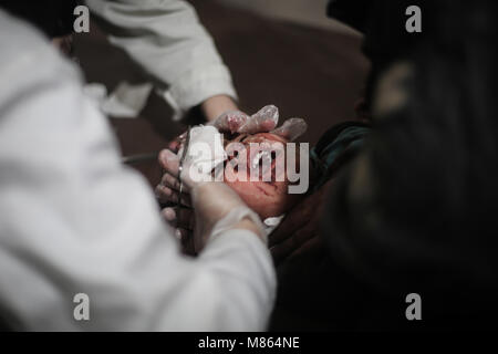 Provincia Ghouta, Siria. Il 15 marzo, 2018. Un ragazzo siriano riceve il primo soccorso in un ospedale di fortuna dopo che egli è stato ferito nel corso di attacchi aerei dalle forze fedeli al presidente siriano Assad in Kafr Batna, un sobborgo esterno a Damasco in Siria orientale della provincia Al-Ghouta, 15 marzo 2018. Foto: Anas Alkharboutli/dpa Credito: dpa picture alliance/Alamy Live News Foto Stock