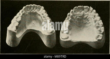 Generale e patologia dentale con particolare riferimento ad eziologia e anatomia patologica; un trattato per studenti e professionisti (1920) (14759674246) Foto Stock