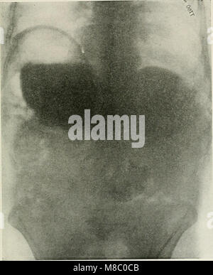 Malattie del torace e i principi della diagnosi di fisica (1920) (14593834700) Foto Stock